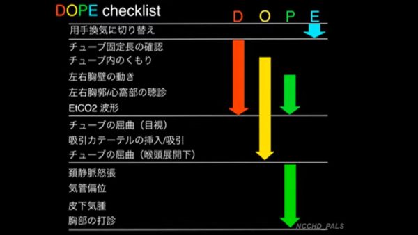 DOPEチェックリスト