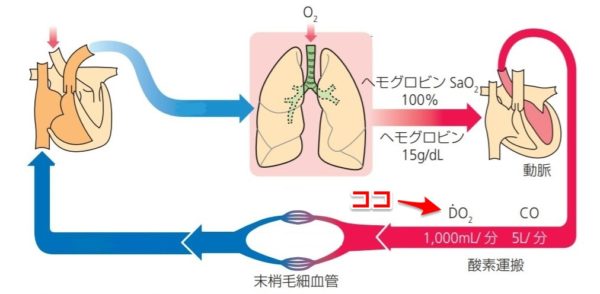 DO2