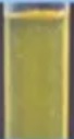 Dyslipidemia2a