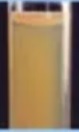 Dyslipidemia3