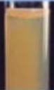 Dyslipidemia4
