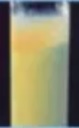 Dyslipidemia5