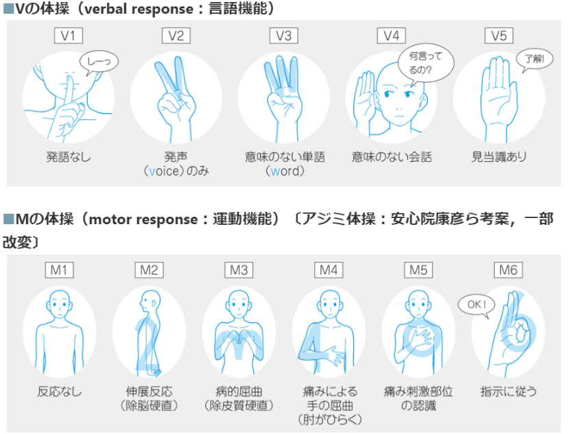 GCS(Glasgow Coma Scale)の覚え方 - どすこい研修医